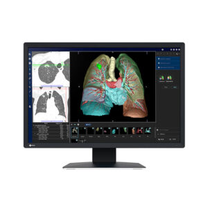 Monitor de Grado Médico RadiForce